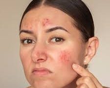 هل تعانين من تعانين من بشرة حساسة تجنبي هذه المواد في مستحضرات التجميل